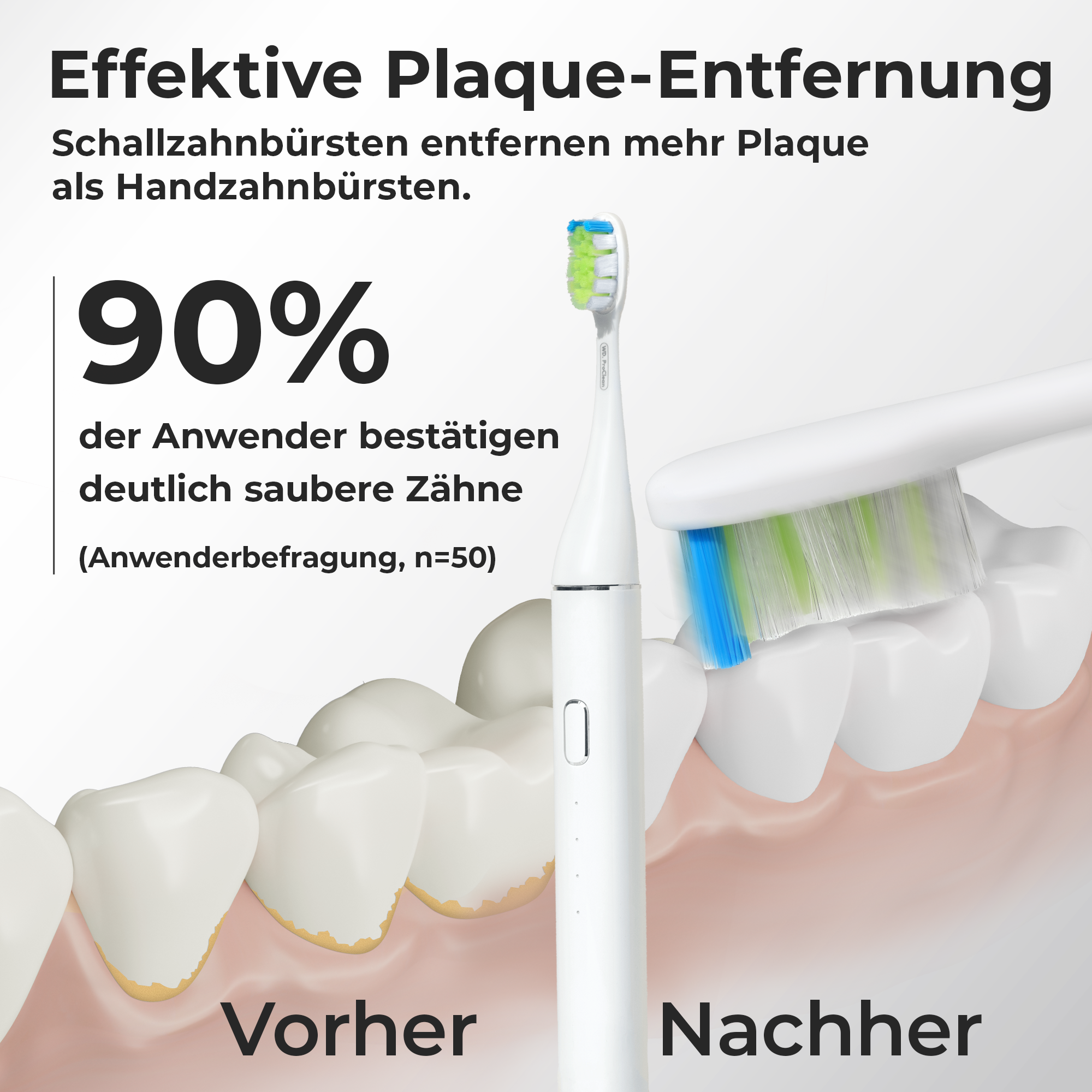 WhyteDOT® Elektrische Schallzahnbürste – sanft & effektiv