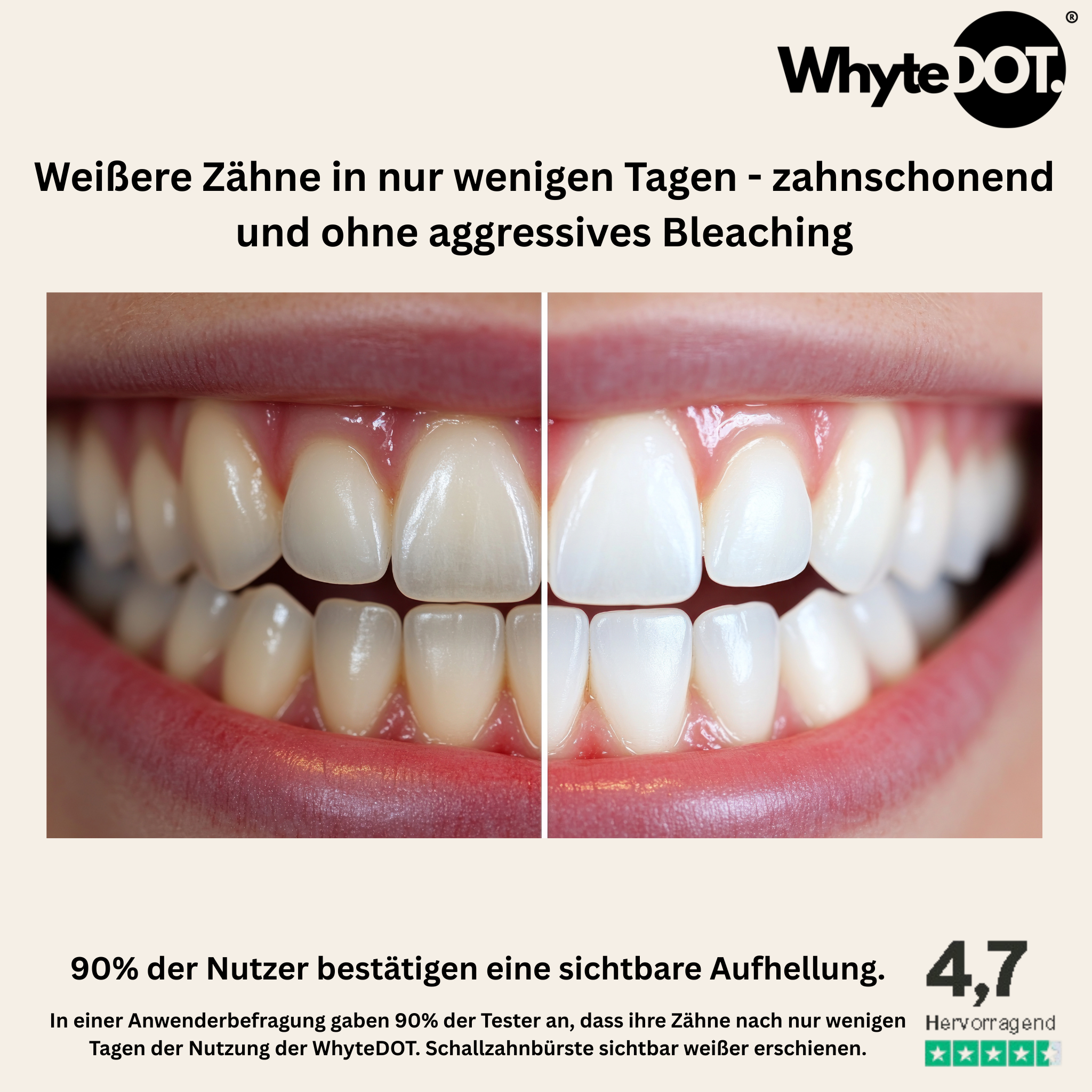WhyteDOT. ultragarso dantų šepetėlis, Oyster White